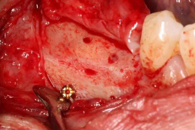 The contents of the Khoury Technique course